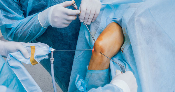 Arthroscopy Surgery Procedure
