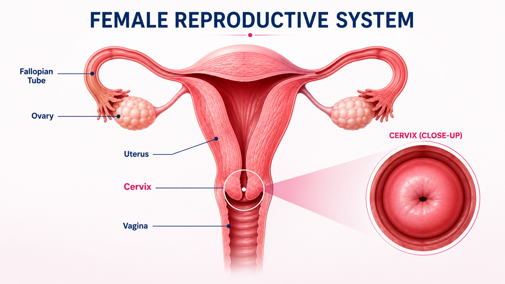 What is cervical cancer