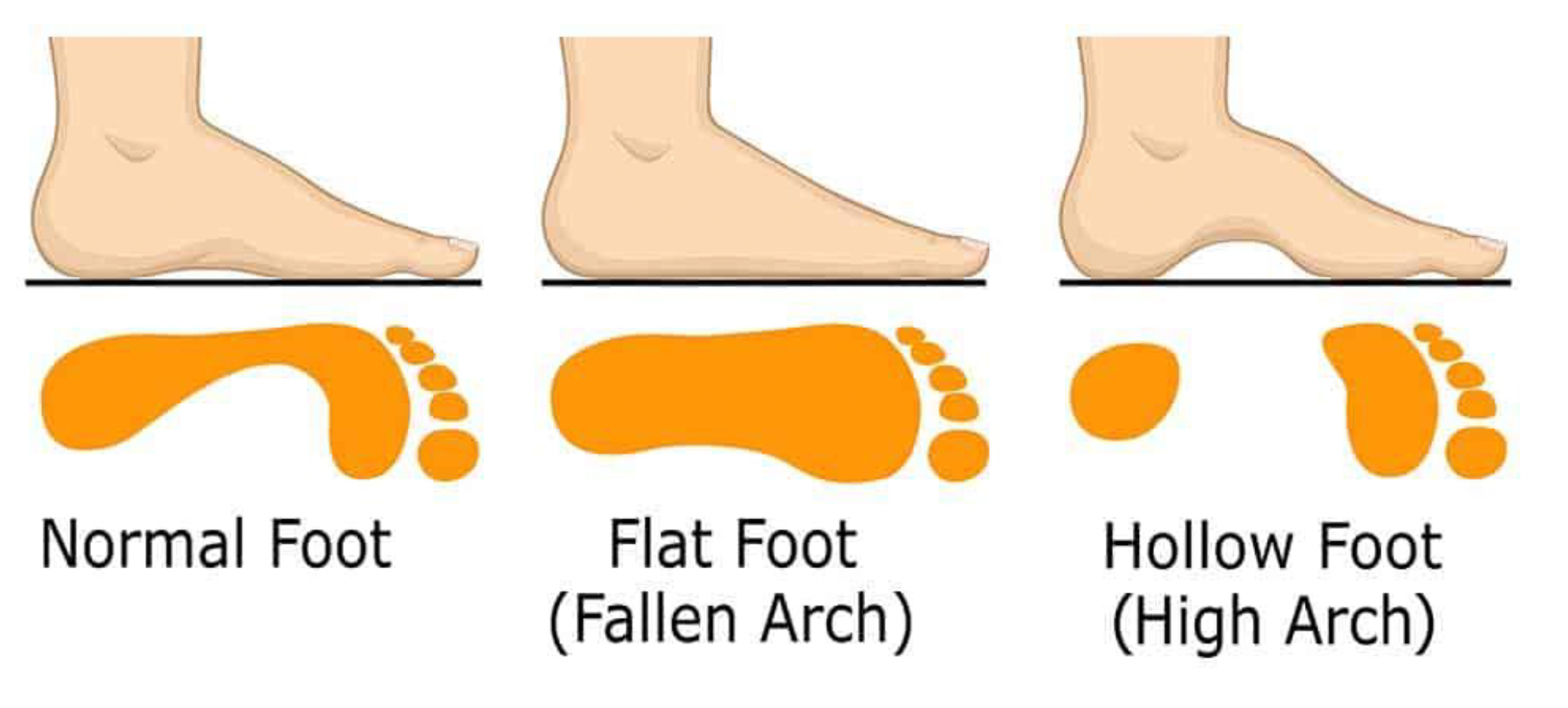 Understanding Normal vs. Concerning Falls in Children