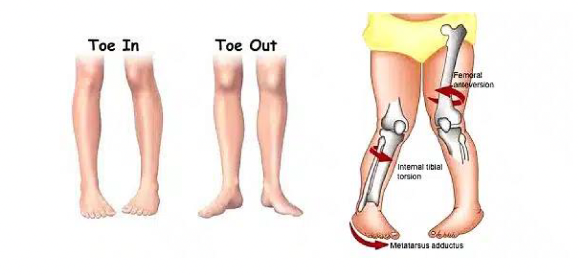 Common Orthopedic Causes of Frequent Falling
