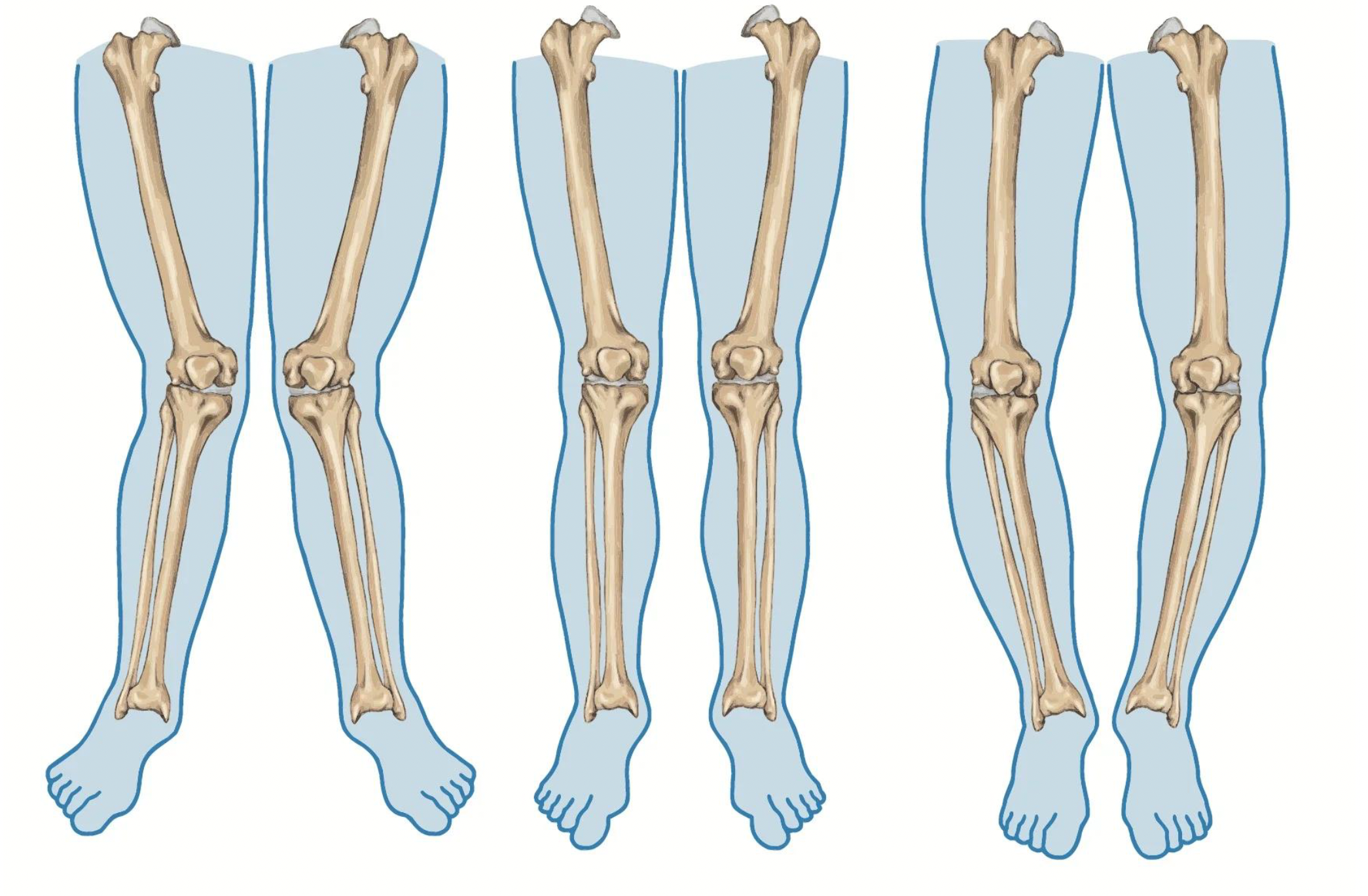 Common Orthopedic Causes of Frequent Falling