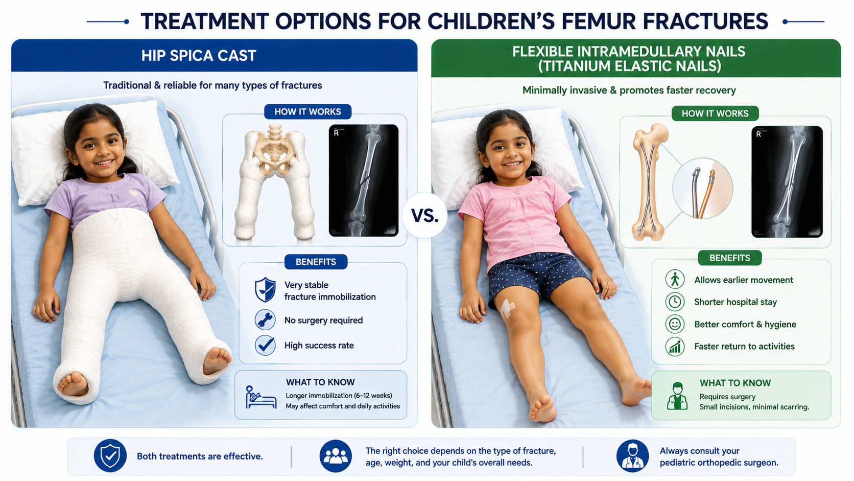 How femur fractures are treated in children