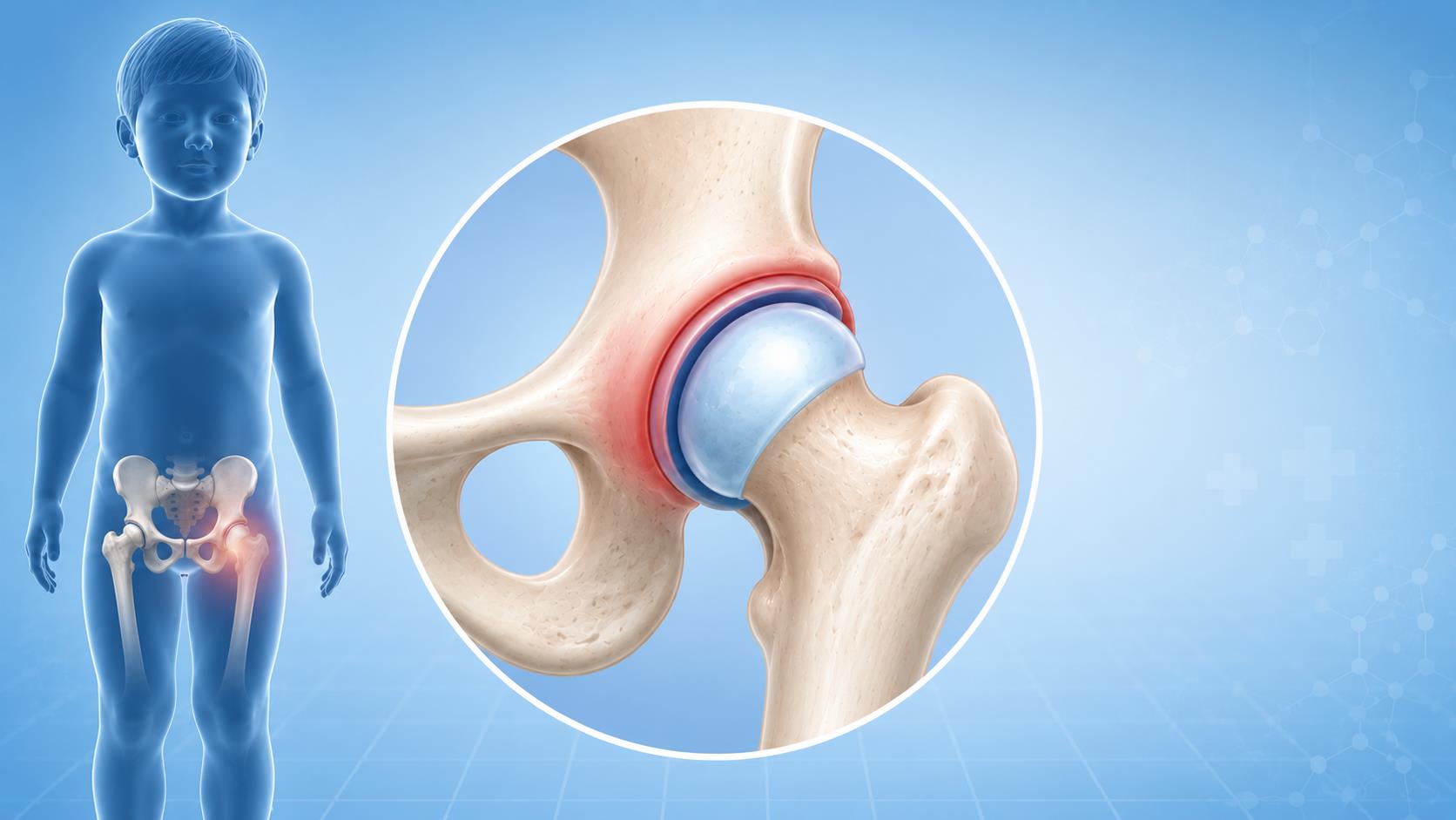 Septic arthritis vs transient synovitis comparison