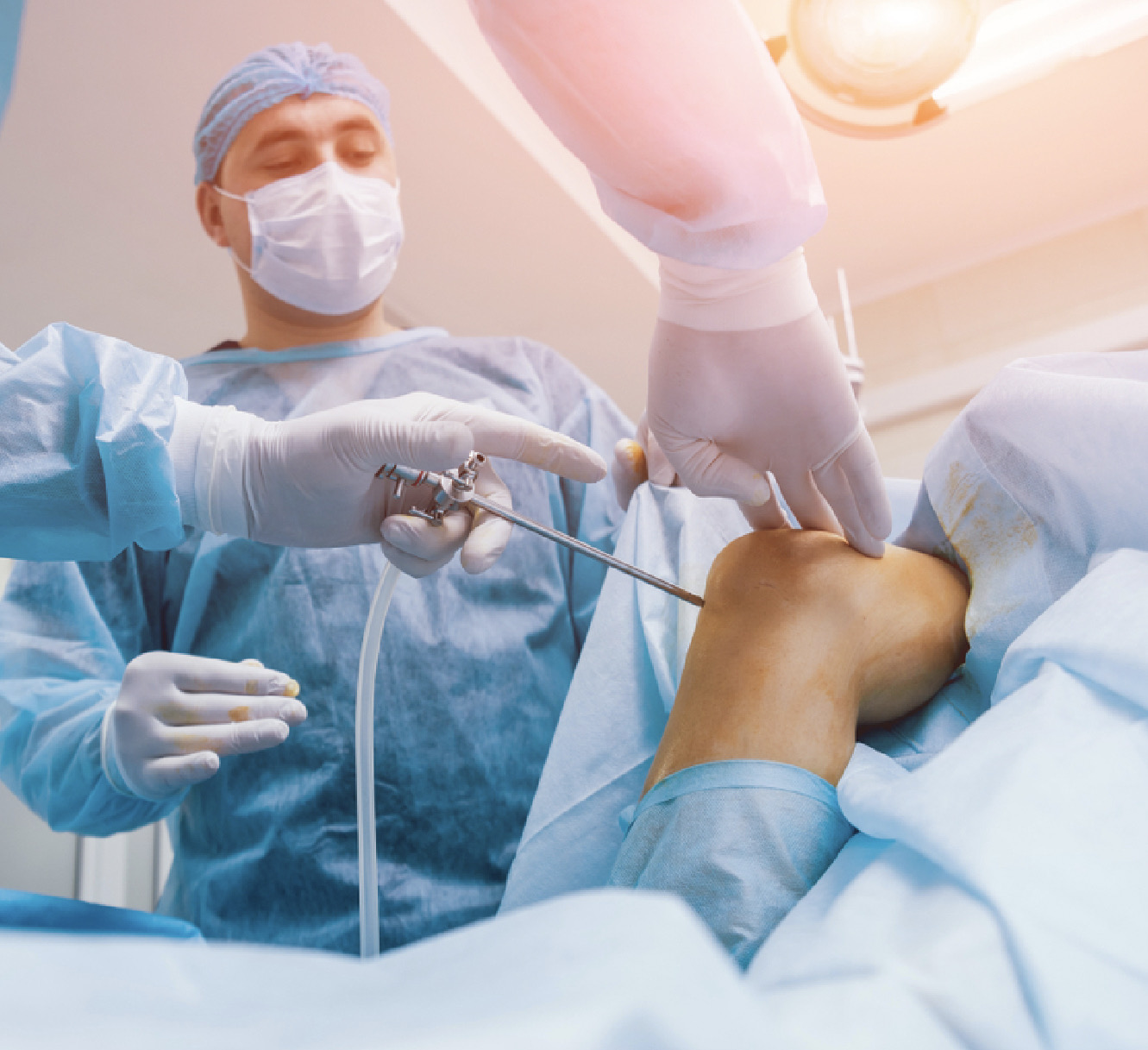 Arthroscopy